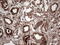 Galectin 3 antibody, LS-C339251, Lifespan Biosciences, Immunohistochemistry paraffin image 