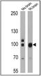 Discs Large MAGUK Scaffold Protein 4 antibody, MA1-045, Invitrogen Antibodies, Western Blot image 