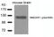 Glutamate Ionotropic Receptor NMDA Type Subunit 1 antibody, PA5-37589, Invitrogen Antibodies, Western Blot image 