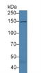 Collagen Type XVI Alpha 1 Chain antibody, LS-C374327, Lifespan Biosciences, Western Blot image 