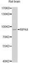 Receptor Interacting Serine/Threonine Kinase 4 antibody, A12580, ABclonal Technology, Western Blot image 