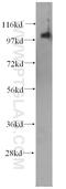 Inositol-Trisphosphate 3-Kinase C antibody, 14267-1-AP, Proteintech Group, Western Blot image 