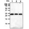 Killer Cell Lectin Like Receptor D1 antibody, GTX57720, GeneTex, Western Blot image 