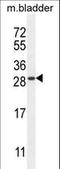 TIFA Inhibitor antibody, LS-C161877, Lifespan Biosciences, Western Blot image 