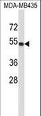 Tubulin Alpha 4a antibody, LS-C160328, Lifespan Biosciences, Western Blot image 