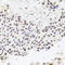Ribonuclease P/MRP Subunit P30 antibody, STJ110777, St John