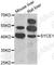 Synaptonemal Complex Central Element Protein 1 antibody, A7218, ABclonal Technology, Western Blot image 