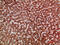 Angiogenin antibody, STJ98719, St John
