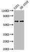 NADPH Oxidase 4 antibody, LS-C317695, Lifespan Biosciences, Western Blot image 