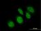 RB Binding Protein 9, Serine Hydrolase antibody, H00010741-B01P, Novus Biologicals, Immunocytochemistry image 
