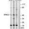 Inositol Hexakisphosphate Kinase 2 antibody, PA5-49891, Invitrogen Antibodies, Western Blot image 