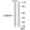 Cyclin Dependent Kinase 5 Regulatory Subunit 1 antibody, A02595, Boster Biological Technology, Western Blot image 