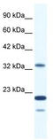 Zinc Finger Protein 688 antibody, TA341461, Origene, Western Blot image 