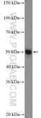 Whirlin antibody, 25881-1-AP, Proteintech Group, Enzyme Linked Immunosorbent Assay image 