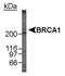 BRCA1 DNA Repair Associated antibody, NB100-600, Novus Biologicals, Western Blot image 