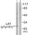 Linker For Activation Of T Cells antibody, PA5-38291, Invitrogen Antibodies, Western Blot image 