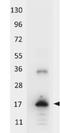AKT Serine/Threonine Kinase 2 antibody, orb345018, Biorbyt, Western Blot image 