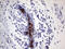 Anterior Gradient 2, Protein Disulphide Isomerase Family Member antibody, LS-C792227, Lifespan Biosciences, Immunohistochemistry paraffin image 