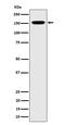 Nucleoporin 155 antibody, M06391, Boster Biological Technology, Western Blot image 