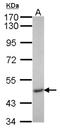Inositol Hexakisphosphate Kinase 2 antibody, NBP1-32322, Novus Biologicals, Western Blot image 