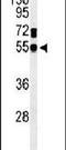 Guanine Deaminase antibody, PA5-26715, Invitrogen Antibodies, Western Blot image 