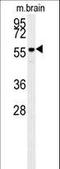 AKT Serine/Threonine Kinase 2 antibody, LS-C156232, Lifespan Biosciences, Western Blot image 