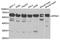 Karyopherin Subunit Alpha 1 antibody, LS-C748664, Lifespan Biosciences, Western Blot image 