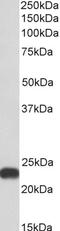 Aldolase, Fructose-Bisphosphate A antibody, 43-518, ProSci, Western Blot image 