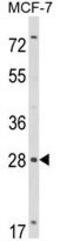 RAS Like Family 11 Member B antibody, GTX81024, GeneTex, Western Blot image 