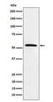 Mixed lineage kinase domain-like protein antibody, M00535-1, Boster Biological Technology, Western Blot image 