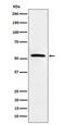 Mixed Lineage Kinase Domain Like Pseudokinase antibody, M00535-1, Boster Biological Technology, Western Blot image 