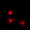 Histone Deacetylase 8 antibody, orb224107, Biorbyt, Immunofluorescence image 