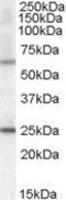 Collagen Type IV Alpha 3 Binding Protein antibody, GTX88855, GeneTex, Western Blot image 