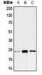 Acidic Nuclear Phosphoprotein 32 Family Member C antibody, orb215088, Biorbyt, Western Blot image 