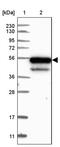 Kelch Repeat And BTB Domain Containing 4 antibody, PA5-58108, Invitrogen Antibodies, Western Blot image 
