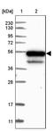 Kelch Repeat And BTB Domain Containing 4 antibody, PA5-58108, Invitrogen Antibodies, Western Blot image 