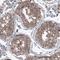 B-Raf Proto-Oncogene, Serine/Threonine Kinase antibody, NBP2-59035, Novus Biologicals, Immunohistochemistry paraffin image 
