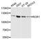 Receptor Tyrosine Kinase Like Orphan Receptor 1 antibody, MBS129572, MyBioSource, Western Blot image 