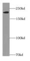 Myosin Heavy Chain 6 antibody, FNab05477, FineTest, Western Blot image 