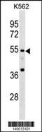 Eukaryotic Translation Initiation Factor 3 Subunit E antibody, 60-526, ProSci, Western Blot image 