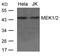 Mitogen-Activated Protein Kinase Kinase 1 antibody, 79-648, ProSci, Western Blot image 