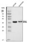 G Protein Subunit Alpha L antibody, A09404-1, Boster Biological Technology, Western Blot image 