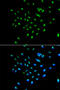 G Protein Nucleolar 3 antibody, STJ28542, St John