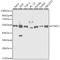 TNF Receptor Associated Factor 2 antibody, GTX16381, GeneTex, Western Blot image 