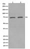Kinesin Family Member C1 antibody, M05325, Boster Biological Technology, Western Blot image 