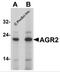 hAG-2 antibody, 7247, ProSci, Western Blot image 