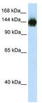 Timeless Circadian Regulator antibody, TA343434, Origene, Western Blot image 