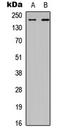 Chromodomain Helicase DNA Binding Protein 2 antibody, LS-C354324, Lifespan Biosciences, Western Blot image 