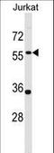 Pannexin 1 antibody, LS-C163354, Lifespan Biosciences, Western Blot image 