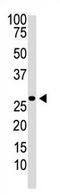 Dickkopf WNT Signaling Pathway Inhibitor 2 antibody, AP11552PU-N, Origene, Western Blot image 
